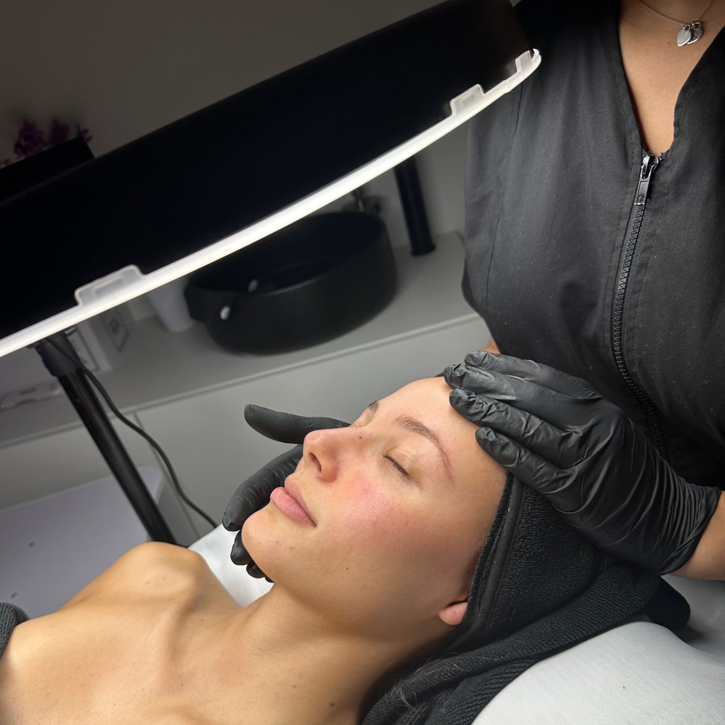 Trattamento Peeling Chimico con Acido Glicolico e Acido Mandelico